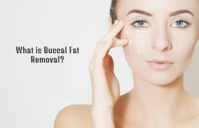 What is Buccal Fat Removal_ 